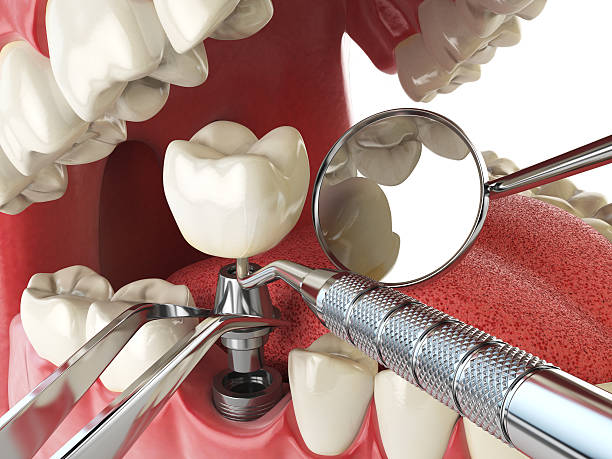 Best Emergency Dental Care for Sports Injuries in Covedale, OH